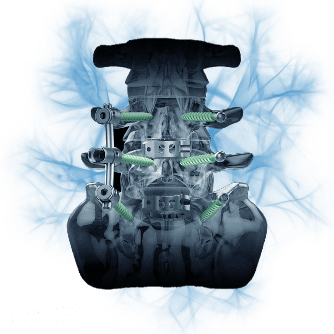 MOSS 100PNG MOSS 100PNG