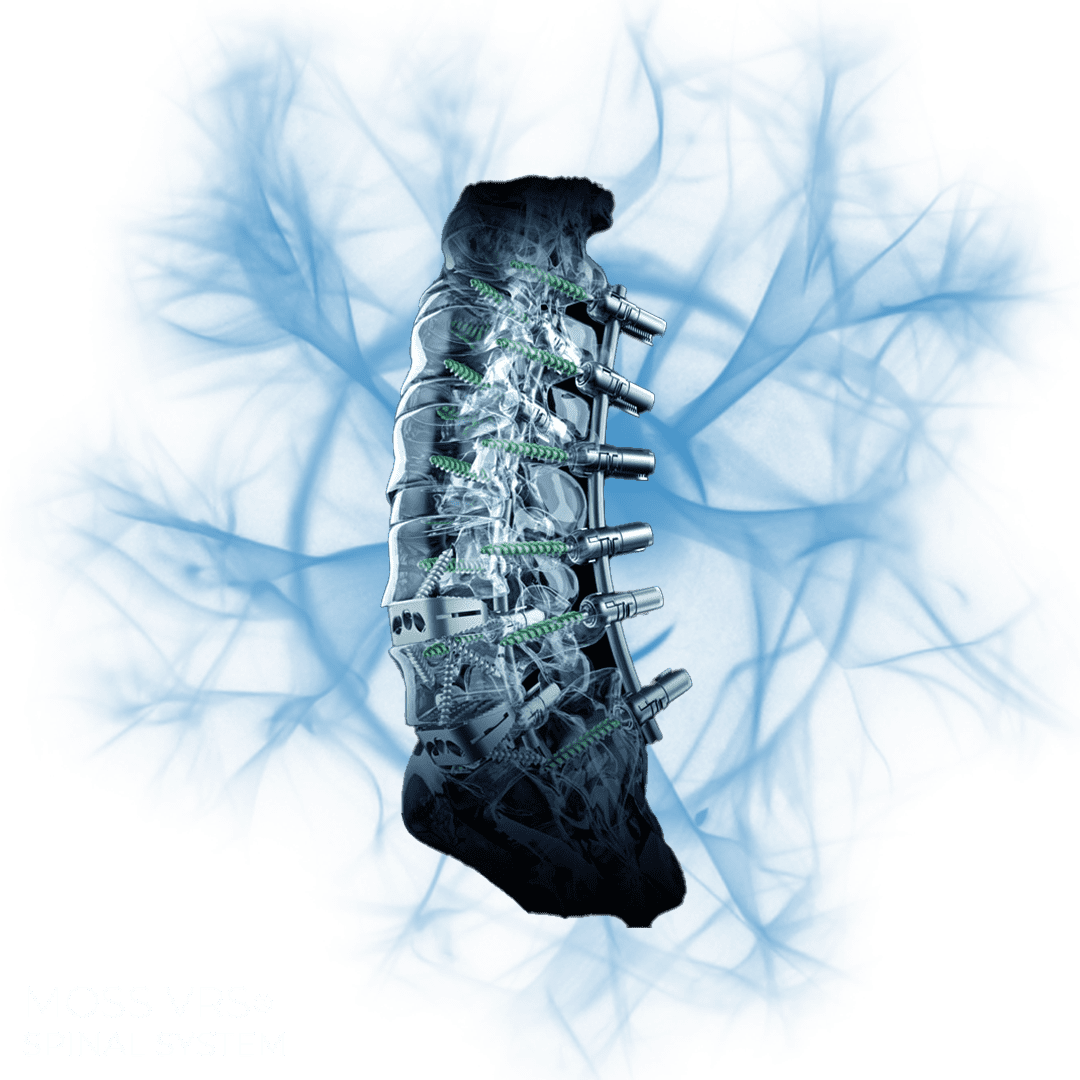 MOSS VRSPNG MOSS VRSPNG